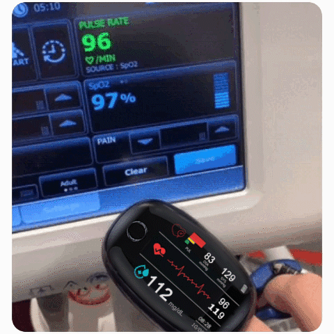 🔥Big Sale - 50% OFF🔥 Non-Invasive Blood Glucose Meter